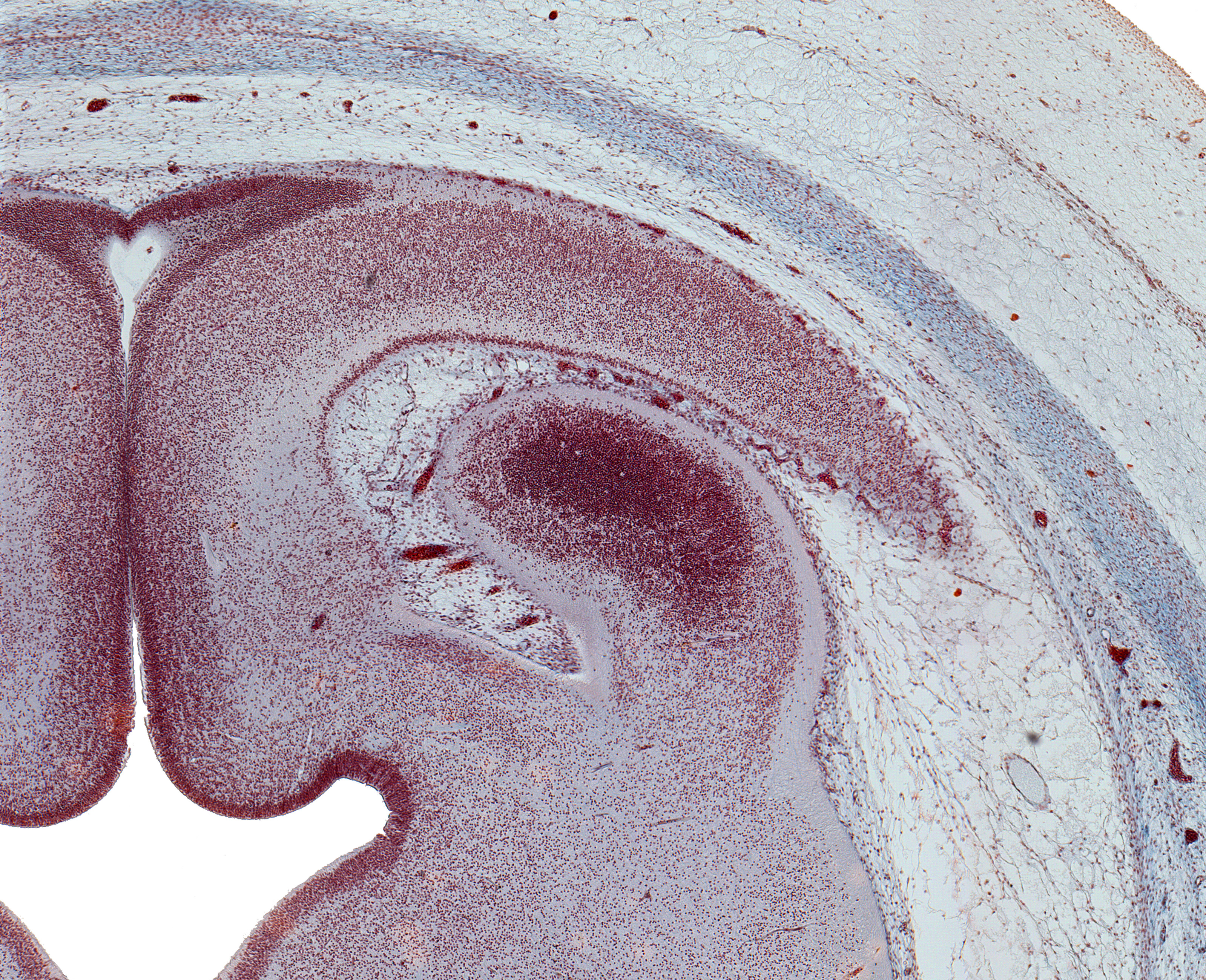 Isthmus of Rhombencephalon, Caudal Inferior Colliculus, and CN IV Rootlets