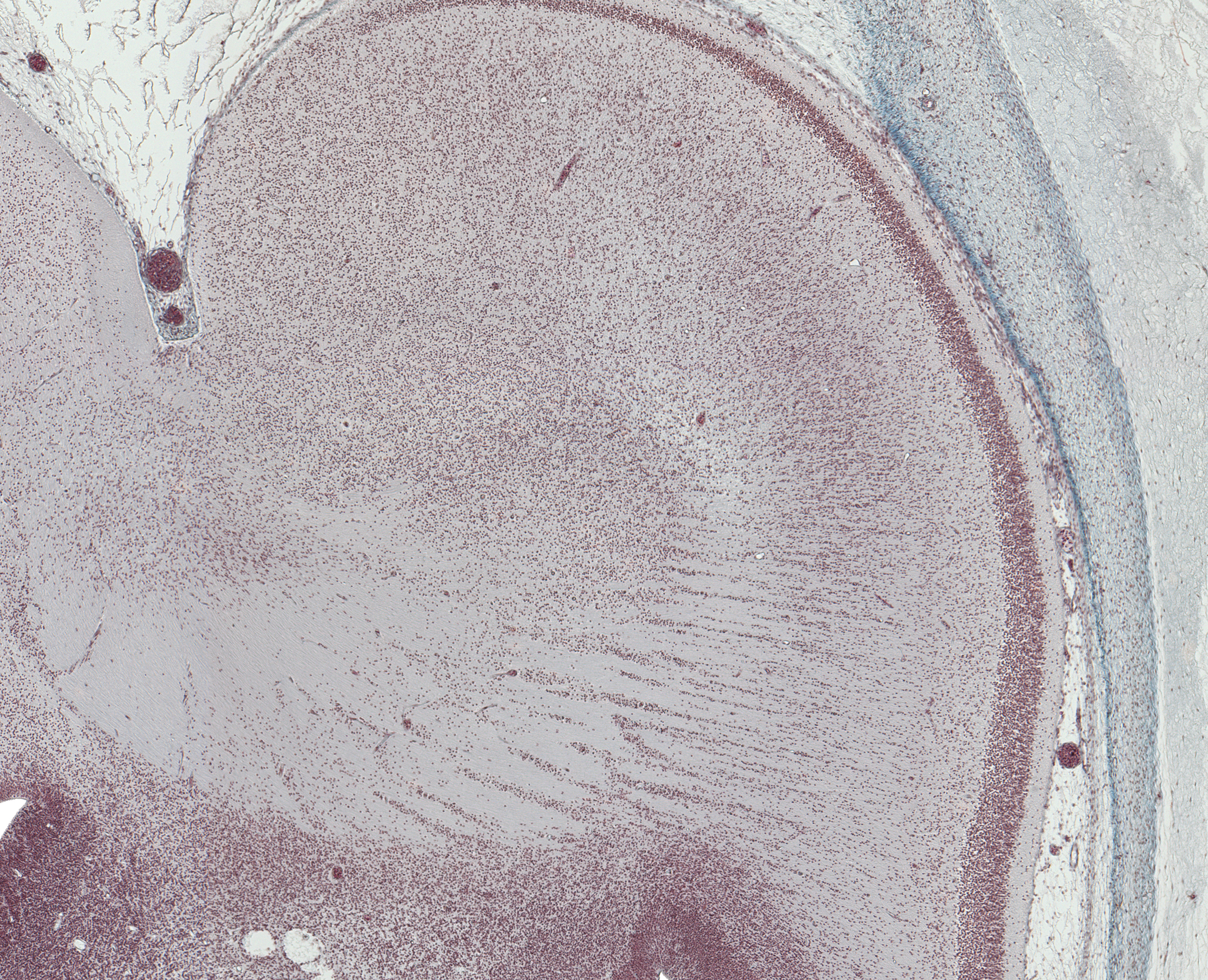 Globus Pallidus, Putamen, and Claustrum