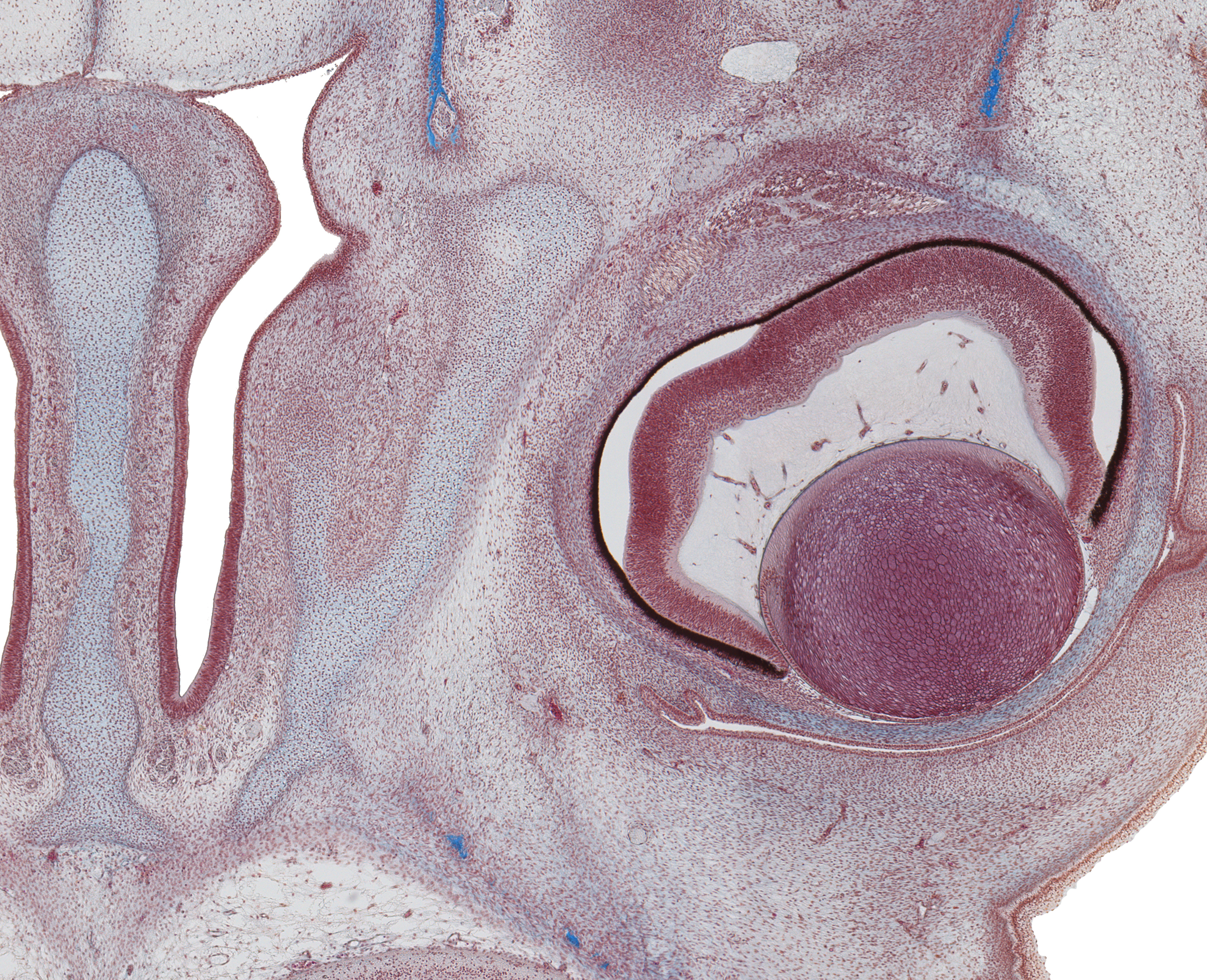 Nasal Cavity and Mid. Eyeball