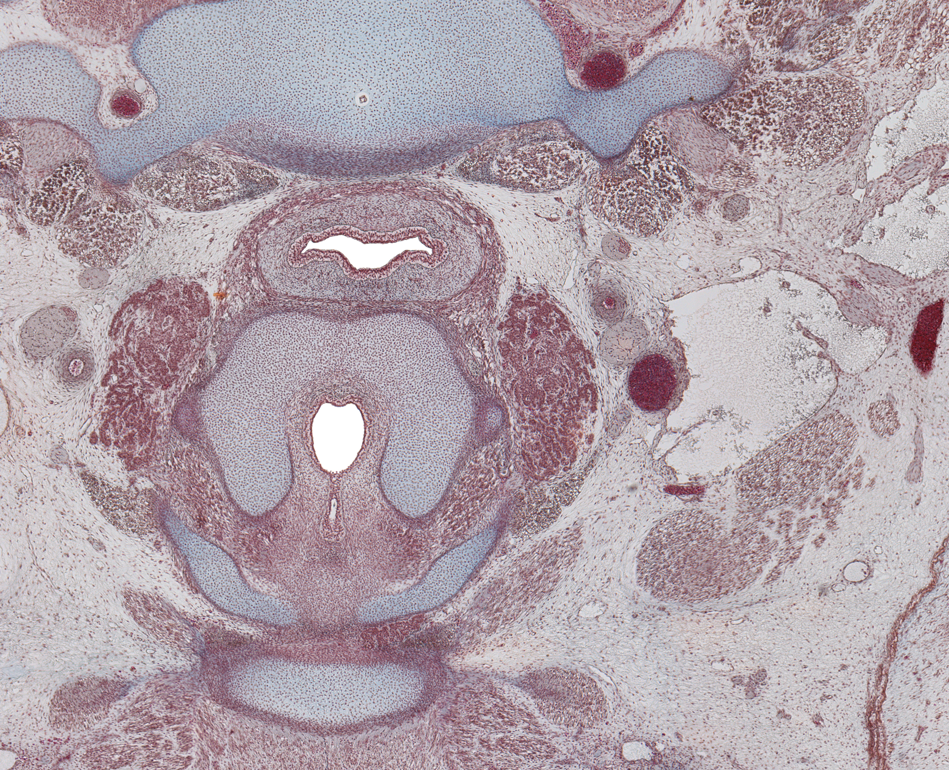 Larynx and Inf. Parathyroid Gland