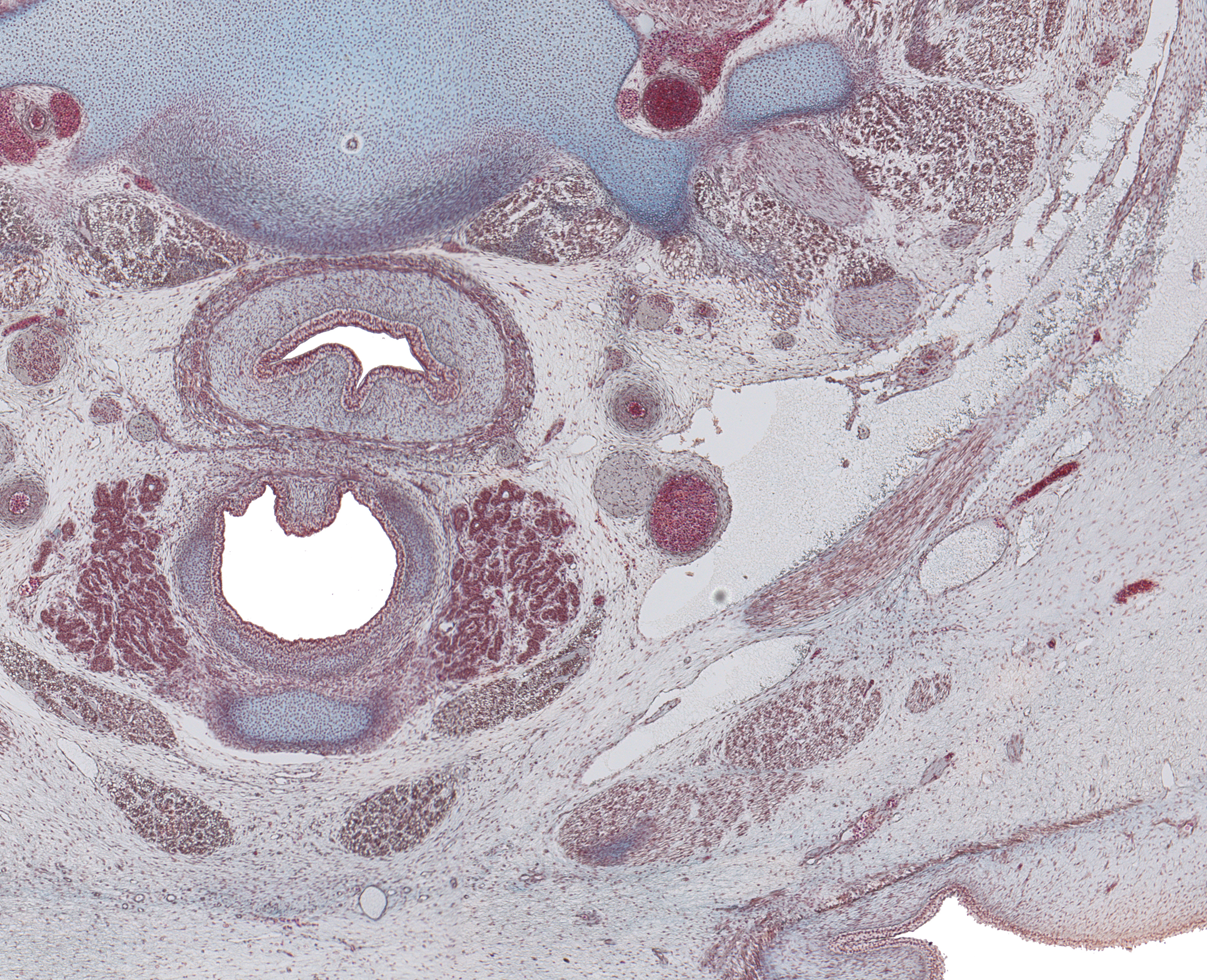 Thyroid Gland and Cartoid Sheath Structures