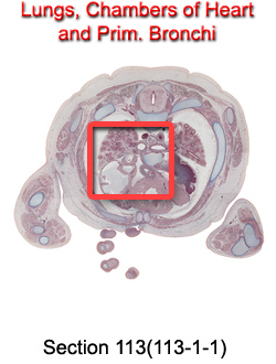 Lungs, Chambers of Heart and Prim. Bronchi