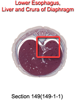 Lower Esophagus, Liver, and Crura of Diaphragm