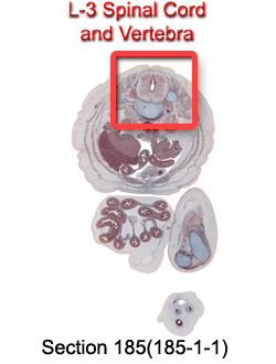 L-3 Spinal Cord and Vertebra