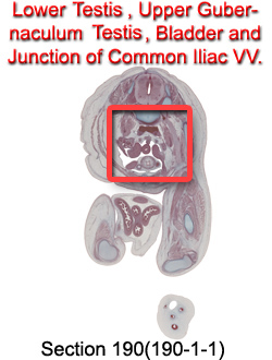 Lower Testis, Upper Gubernaculum Testis, Bladder and Junction of Common Iliac VV.