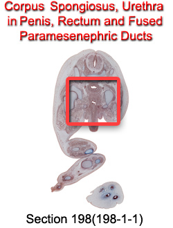 Corpus Spongoisus, Urethra in Penis, Rectum, and Fused Paramesenephric Ducts