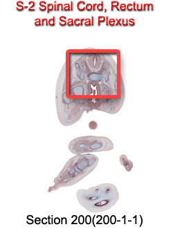 S-2 Spinal Cord, Rectum and Sacral Plexus