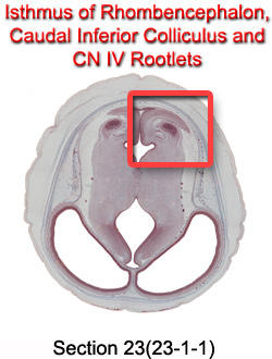 Isthmus of Rhombencephalon, Caudal Inferior Colliculus, and CN IV Rootlets