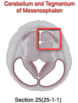 Cerebellum and Tegmentum of Mesencephalon