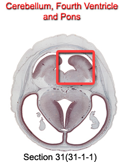 Cerebellum, Fourth Ventricle, and Pons