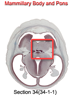 Mammillary Body and Pons