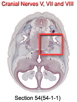 Cranial Nerves V, VII, and VIII