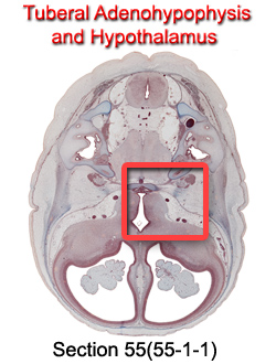 Tuberal Adenohypophysis and Hyptothalamus