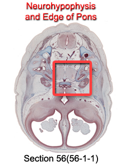 Neurohypophysis and Edge of Pons