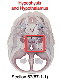 Hypophysis and Hypothalamus