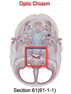 Optic Chiasm