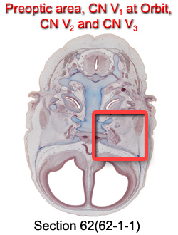 Preoptic area, CN V<sub>1</sub> at Orbit, CN V<sub>2</sub>, and CN V<sub>3</sub>