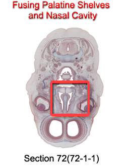 Fusing Palantine Shelves and Nasal Cavity