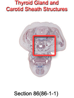 Thyroid Gland and Cartoid Sheath Structures