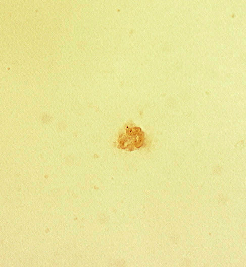 tangential section through trophoblast