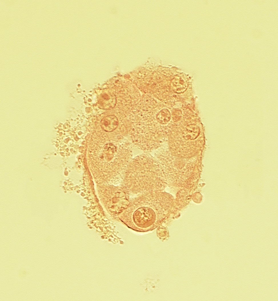 disrupted zona pellucida, edge of blastocystic cavity (blastocoele), nucleus of embryoblast (pluriblast), subzonal space