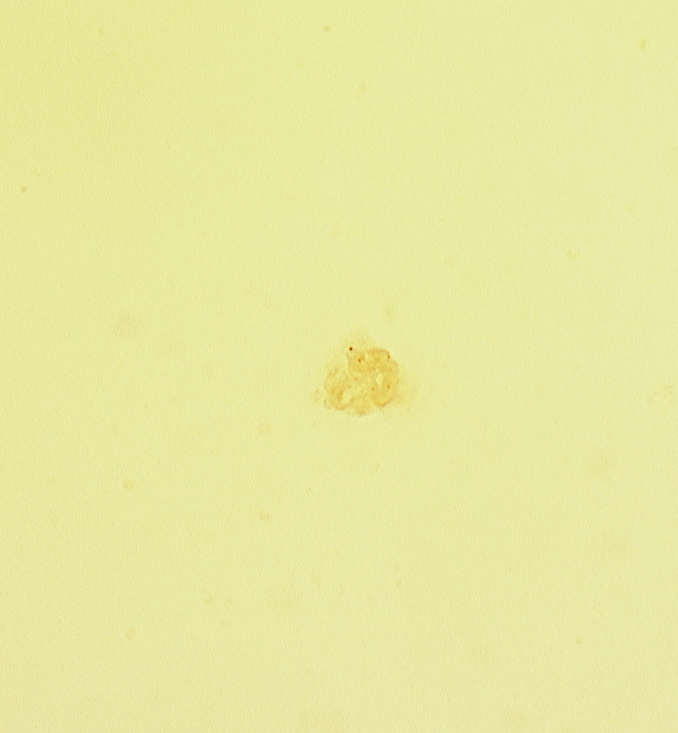 tangential section through trophoblast