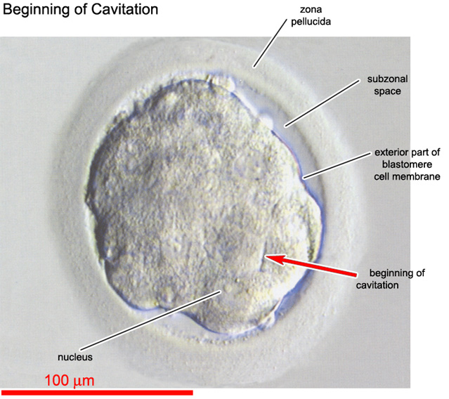 Beginning of cavitation