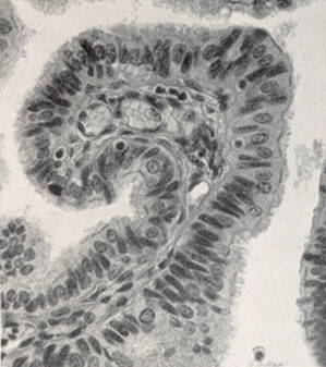 Mucosa of the Fallopian tube