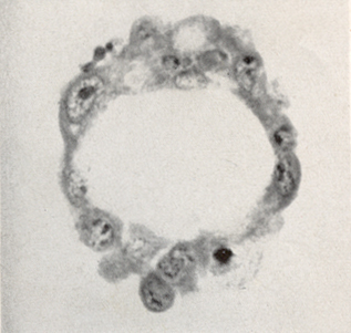 Embryo 8663