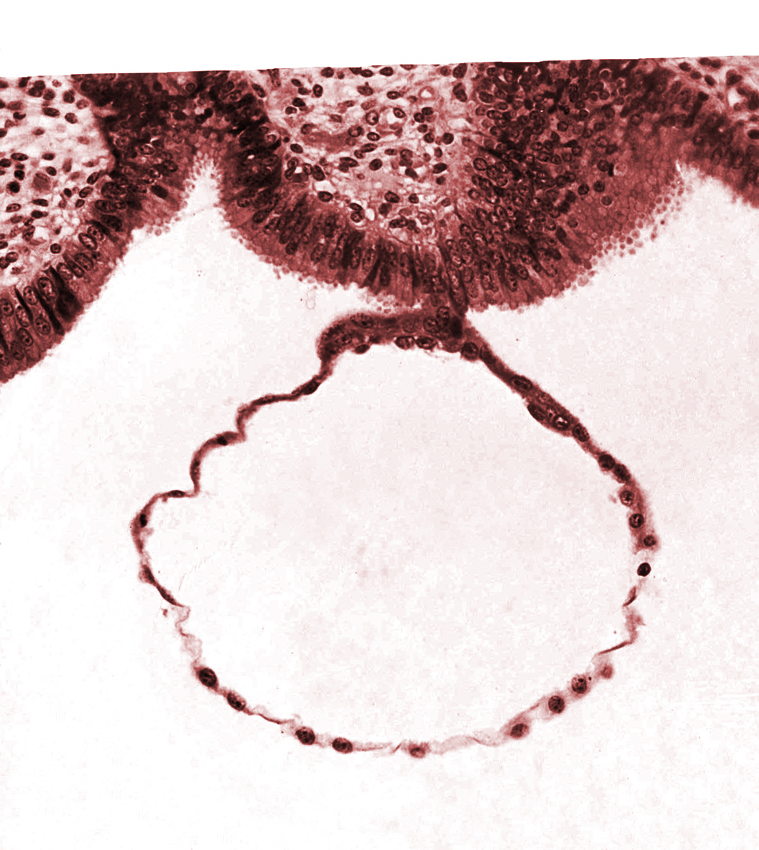 blastocystic cavity (blastocoele), contact area(s), endometrial (uterine) epithelium, endometrial (uterine) stroma, mural trophoblast
