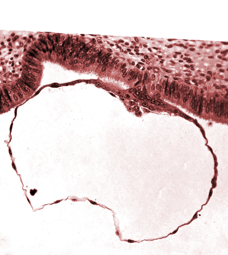 blastocystic cavity (blastocoele), contact area(s), embryonic disc, mural trophoblast