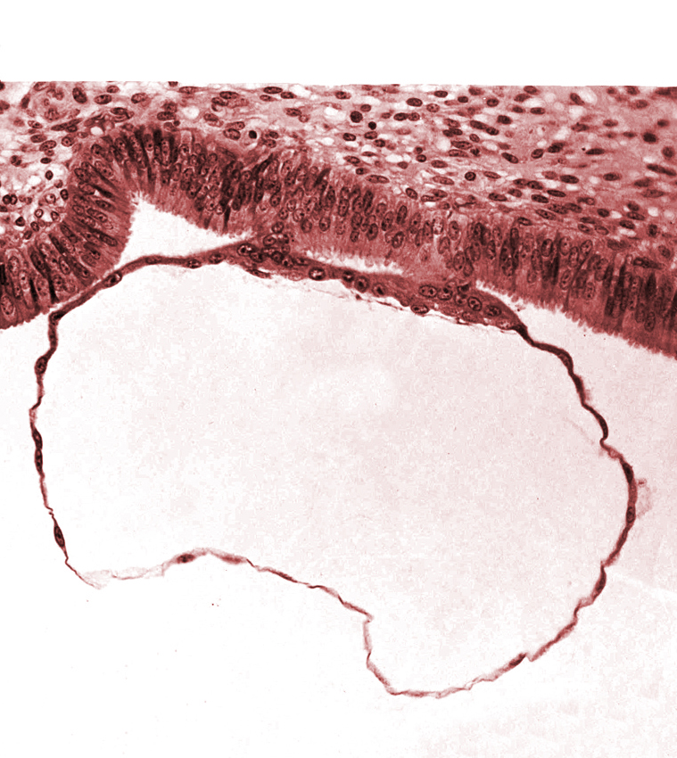 contact area(s), cytotrophoblast, endometrial (uterine) epithelium, endometrial (uterine) stroma, syncytiotrophoblast