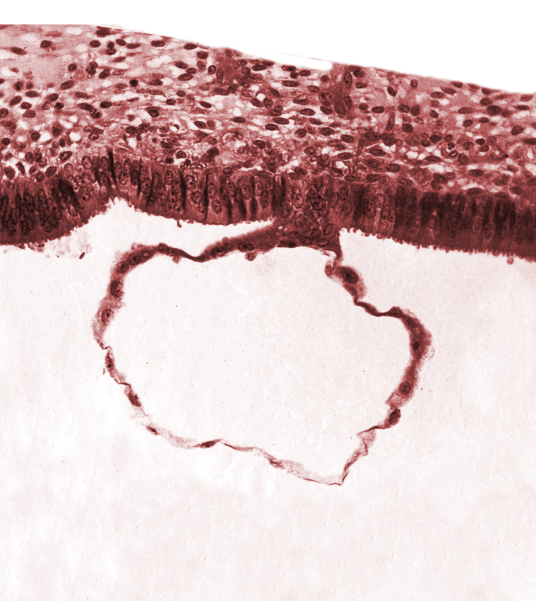 blastocystic cavity (blastocoele), contact area(s), mural trophoblast