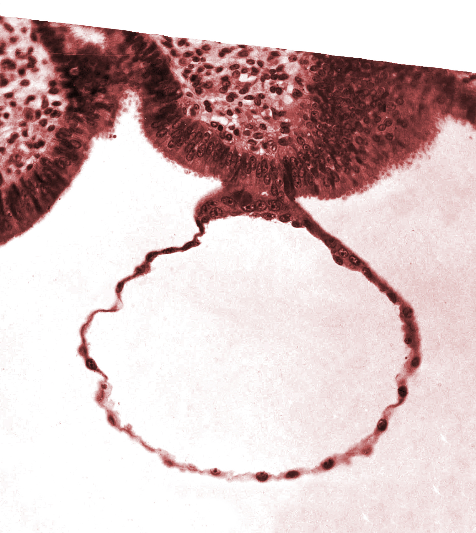 blastocystic cavity (blastocoele), contact area(s), endometrial (uterine) epithelium, mural trophoblast