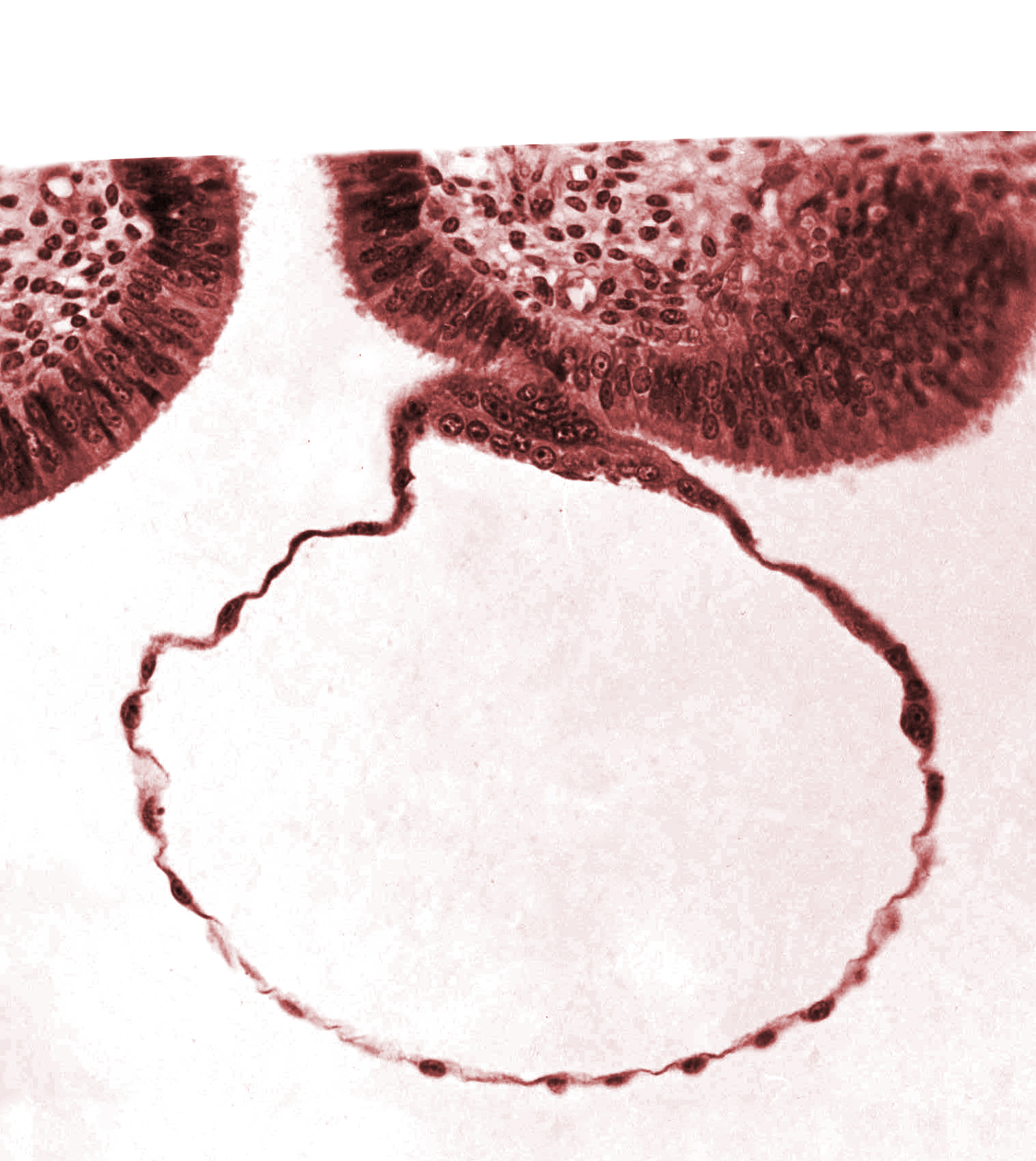 blastocystic cavity (blastocoele), contact area(s), cytotrophoblast, edematous endometrial stroma (decidua), endometrial (uterine) epithelium, mural trophoblast, syncytiotrophoblast