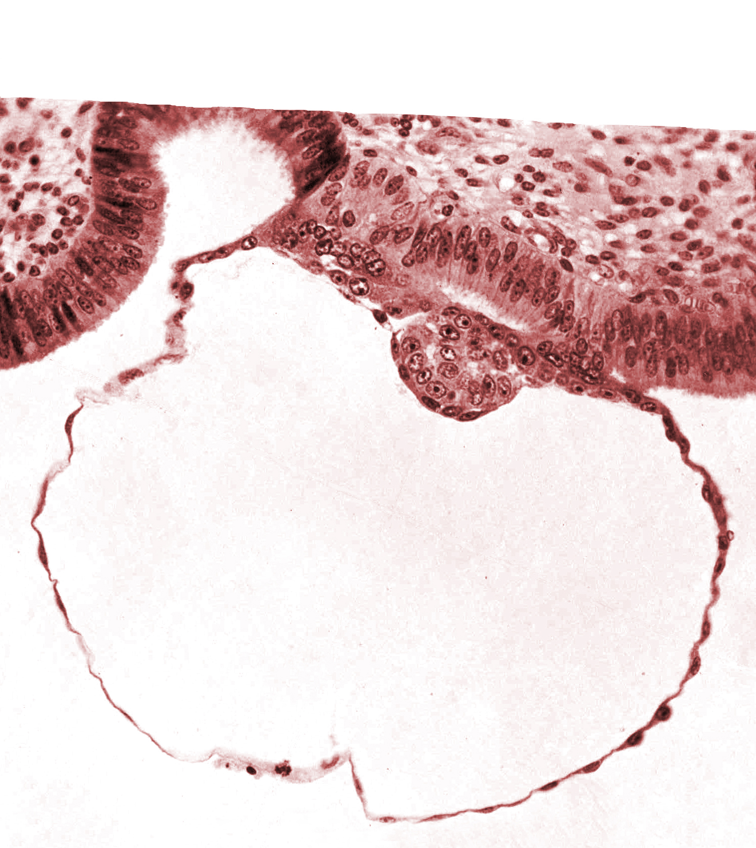 blastocystic cavity (blastocoele), cytotrophoblast, edematous endometrial stroma (decidua), endometrial (uterine) epithelium, epiblast, gap in contact area, hypoblast, mural trophoblast, primordium of amniotic cavity, syncytiotrophoblast