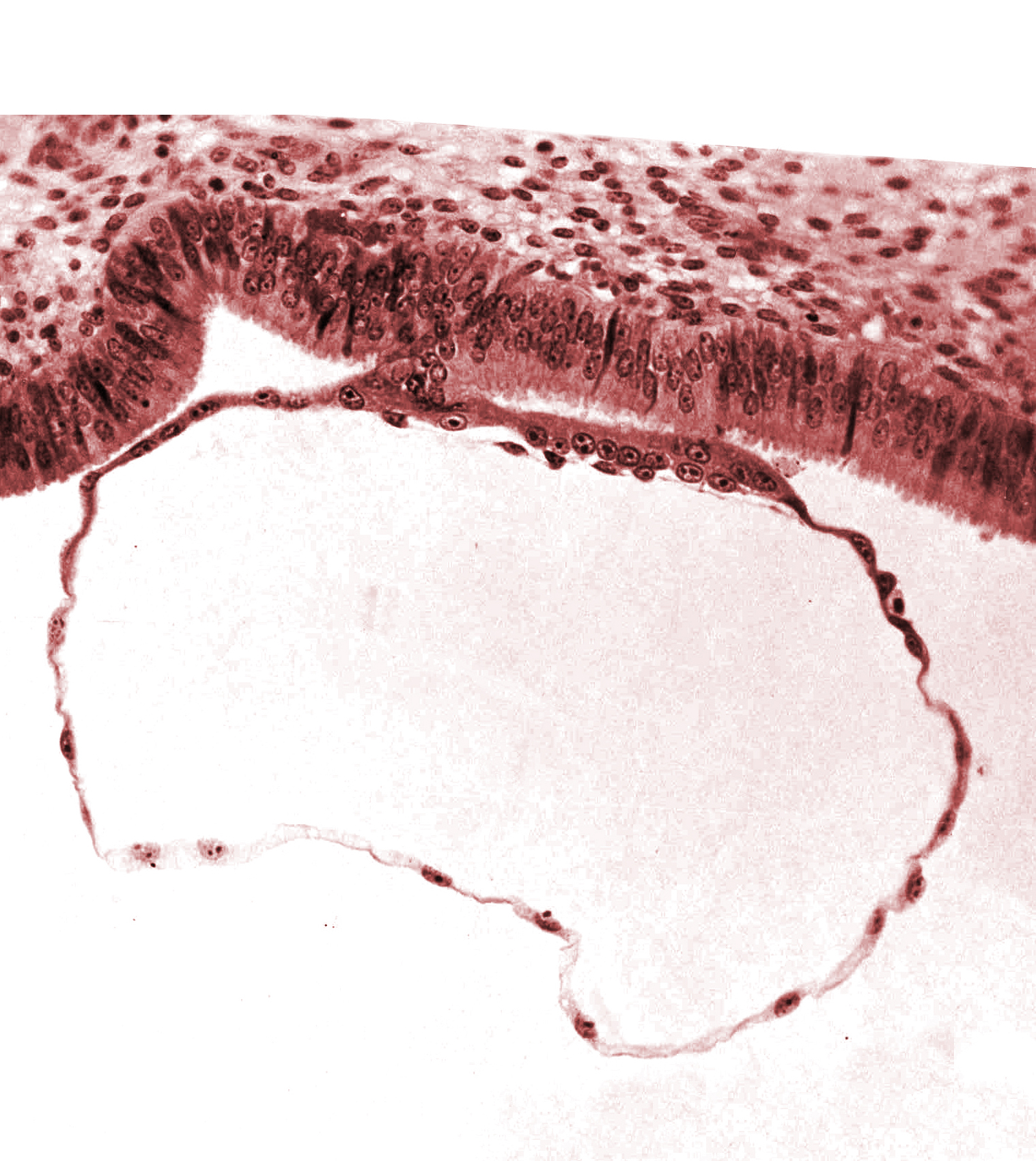 blastocystic cavity (blastocoele), edge of contact area, endometrial (uterine) epithelium, endometrial (uterine) stroma, syncytiotrophoblast