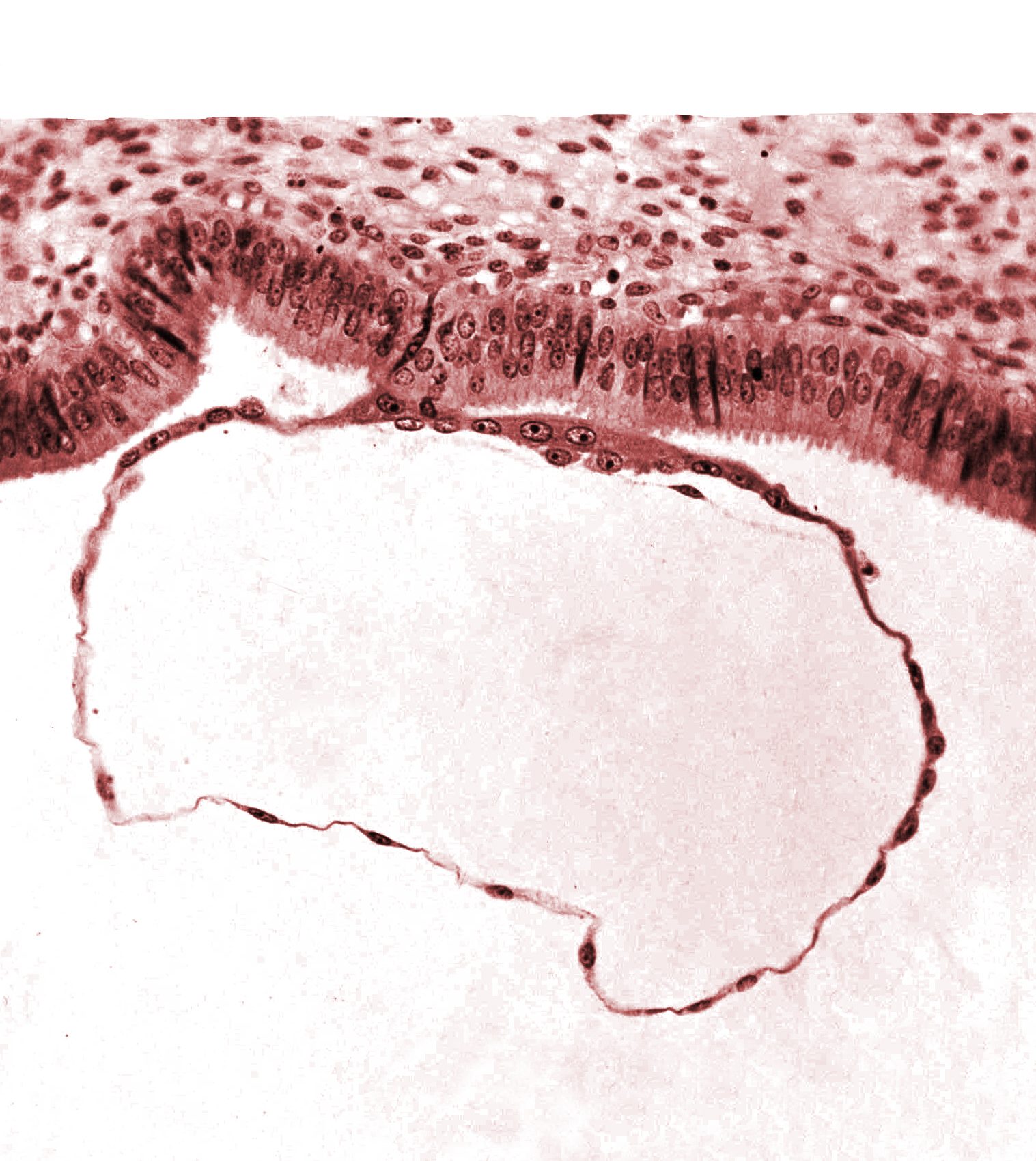 blastocystic cavity (blastocoele), contact area(s), cytotrophoblast, mural trophoblast, syncytiotrophoblast