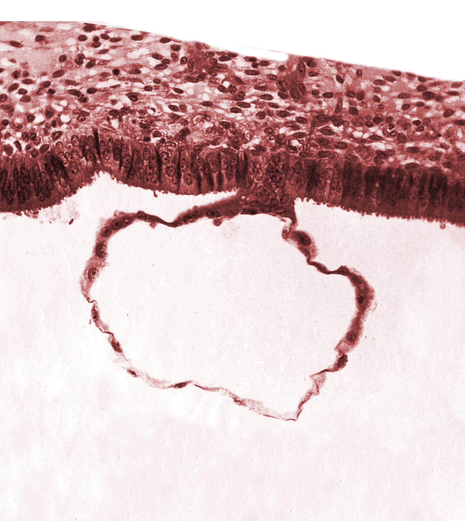 blastocystic cavity (blastocoele), contact area(s), mural trophoblast