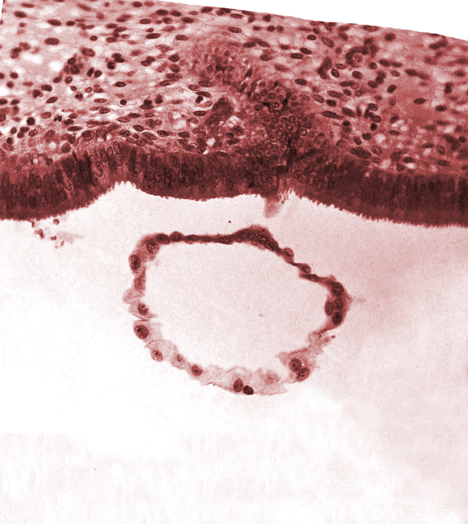 blastocystic cavity (blastocoele), polar trophoblast, tangentially cut mural trophoblast, uterine cavity