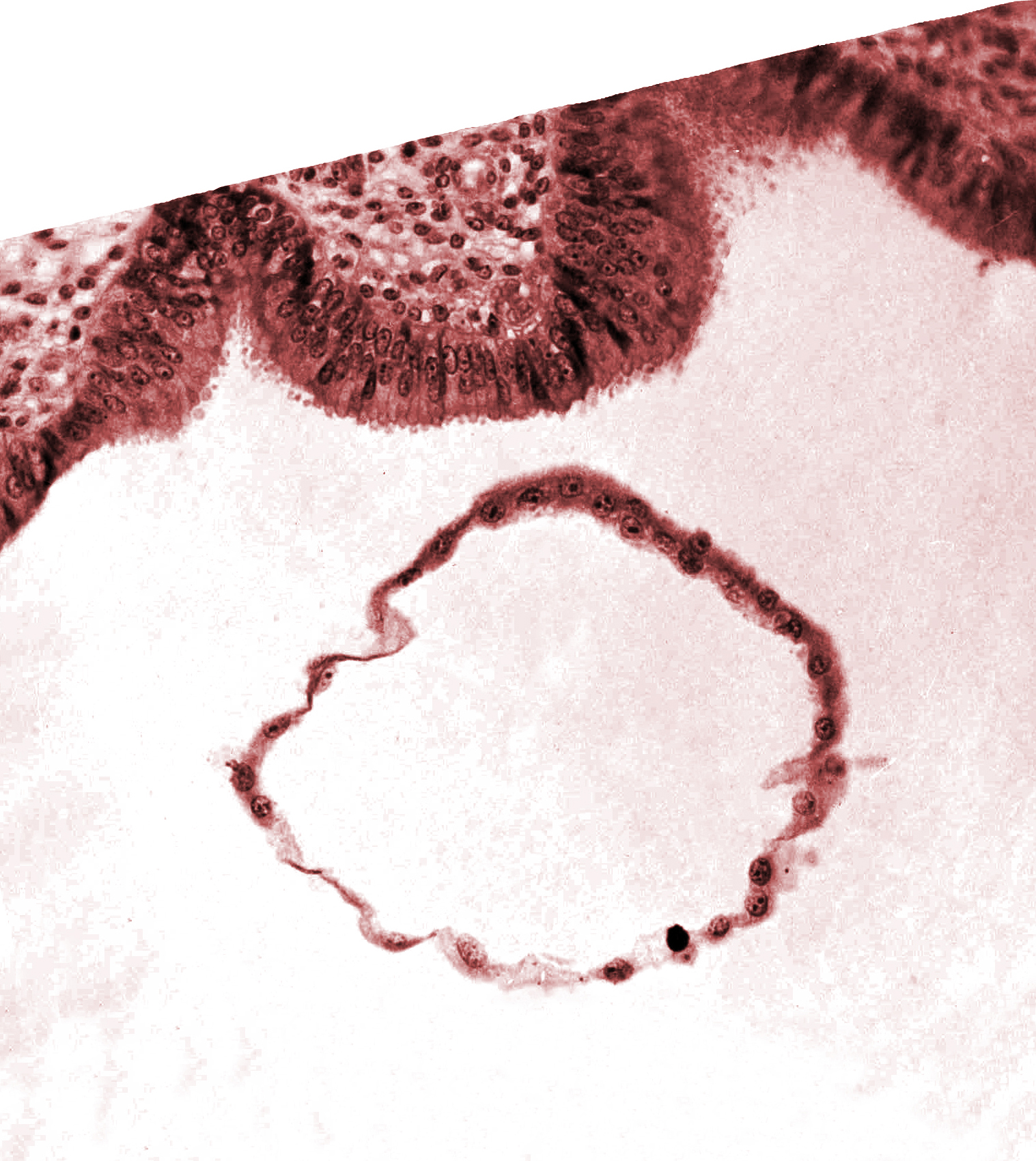 blastocystic cavity (blastocoele), mural trophoblast, uterine cavity