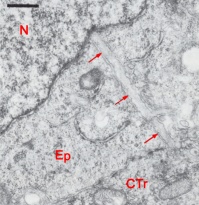 Long slender projection of a cytotrophoblast cell