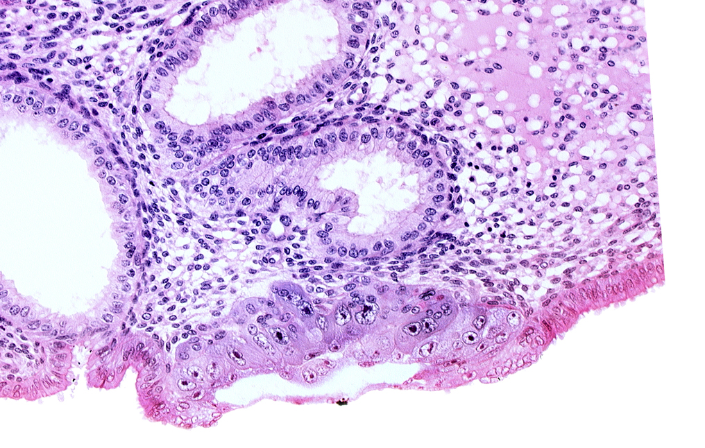 amniotic cavity, edematous endometrial stroma (decidua), embryonic disc, endometrial epithelium, extra-embryonic mesoblast, syncytiotrophoblast / decidua interface