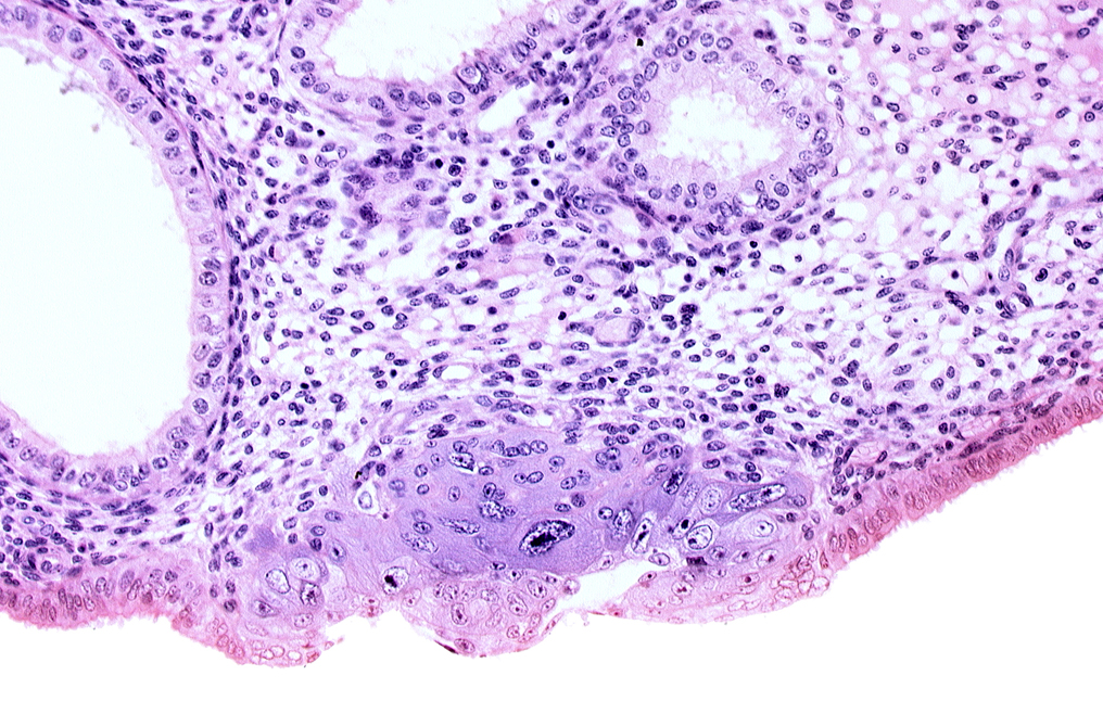 blastocystic cavity (blastocoele), cytotrophoblast, edematous endometrial stroma (decidua), edge of endometrial gland, embryonic disc, endometrial epithelium, membranous trophoblast at abembryonic pole, solid syncytiotrophoblast, syncytiotrophoblast / decidua interface