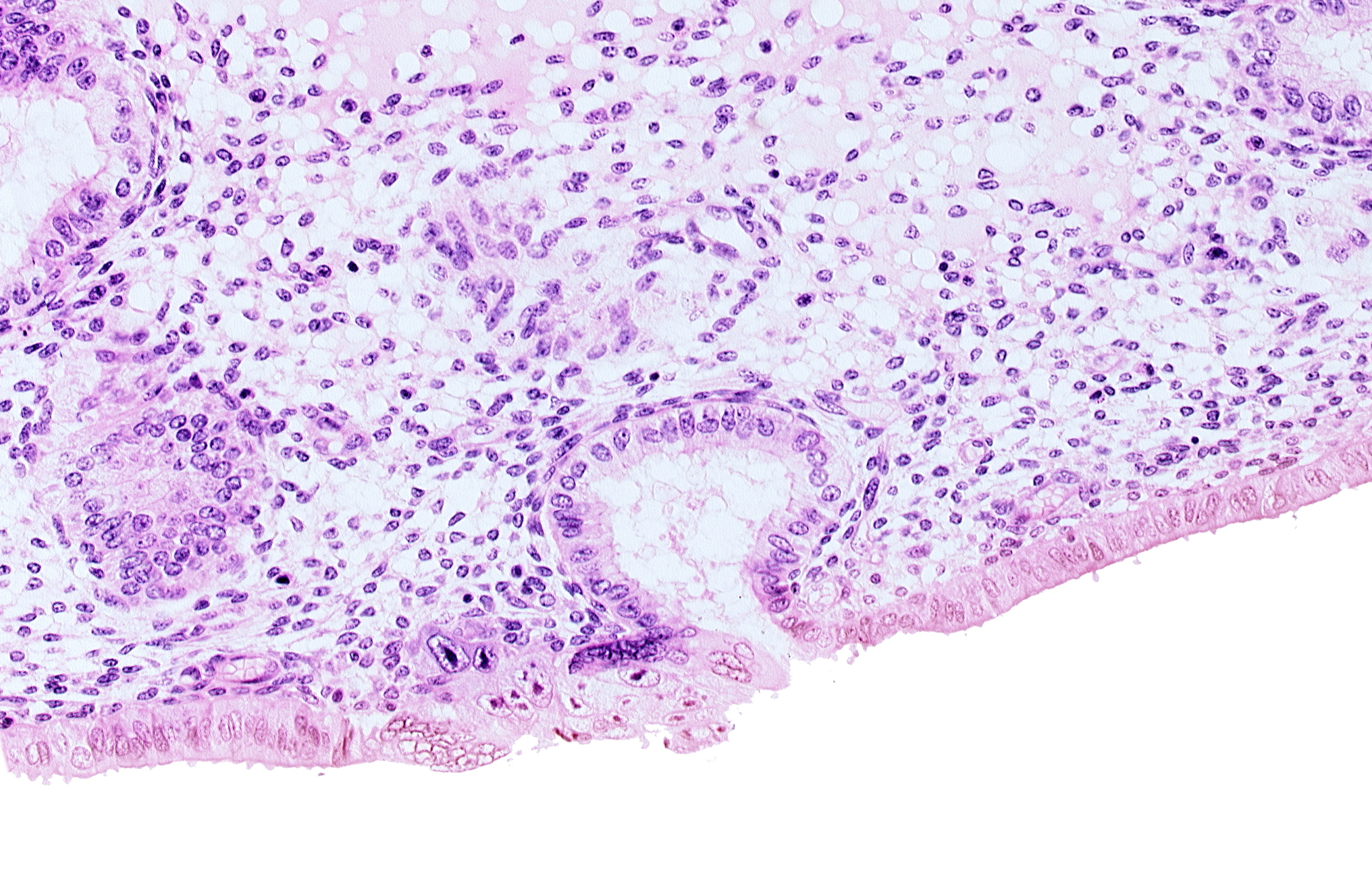 endometrial epithelium, lumen of endometrial gland, mouth of endometrial gland, solid syncytiotrophoblast
