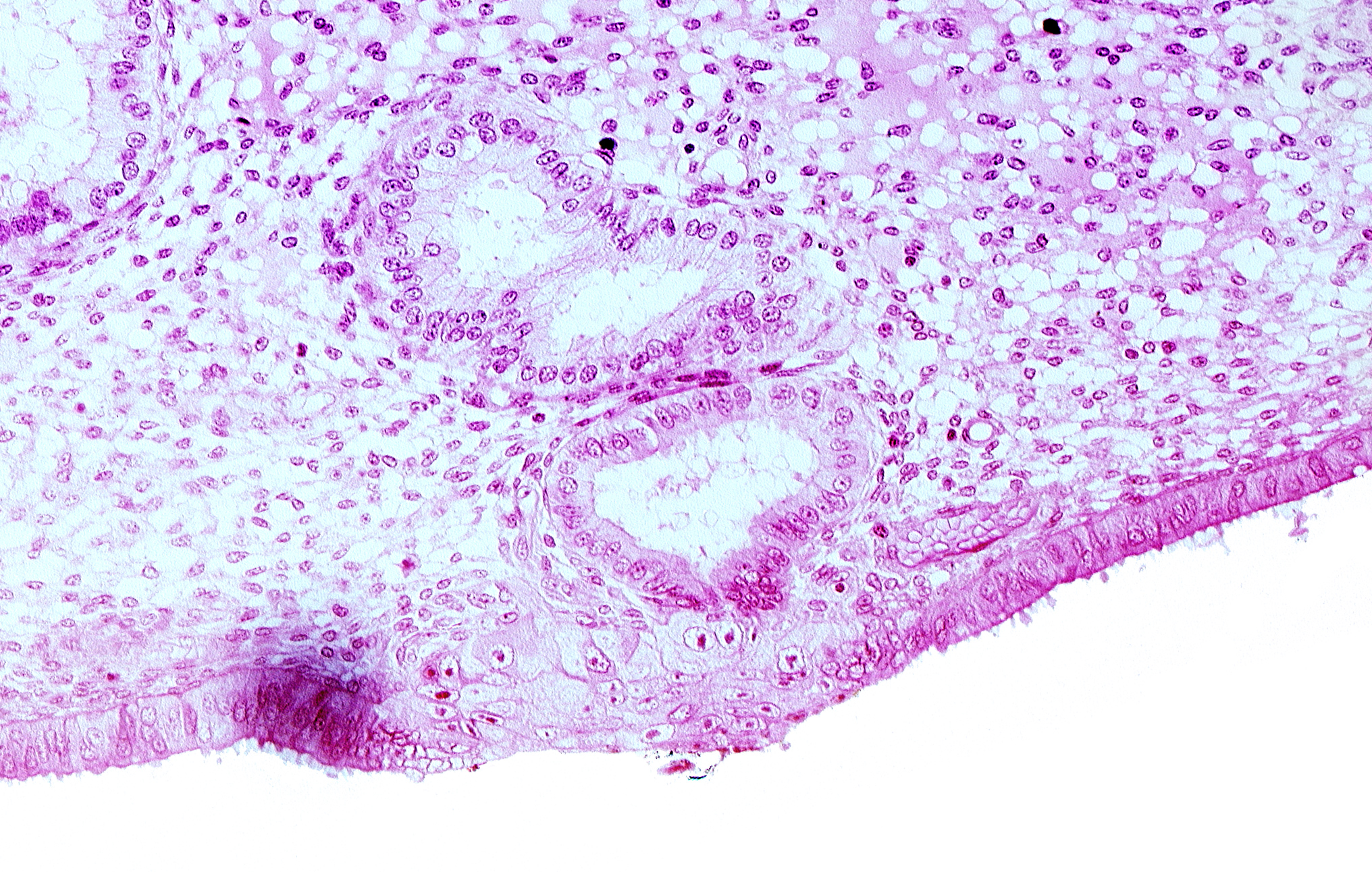 edematous endometrial stroma (decidua), endometrial epithelium, endometrial gland, solid syncytiotrophoblast, uterine cavity