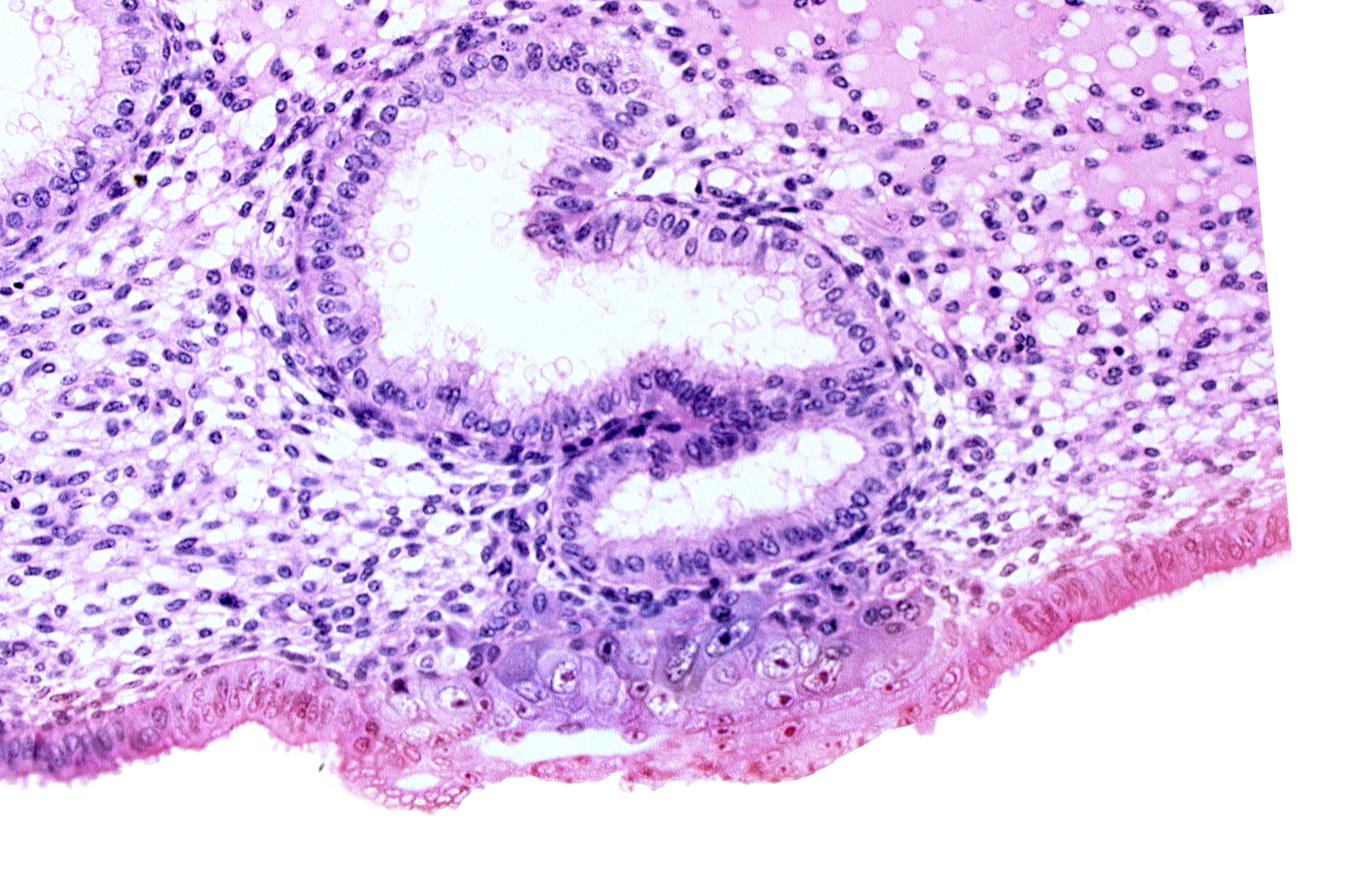 blastocystic cavity (blastocoele), cytotrophoblast, edematous endometrial stroma (decidua), endometrial epithelium, endometrial gland, extra-embryonic mesoblast, solid syncytiotrophoblast