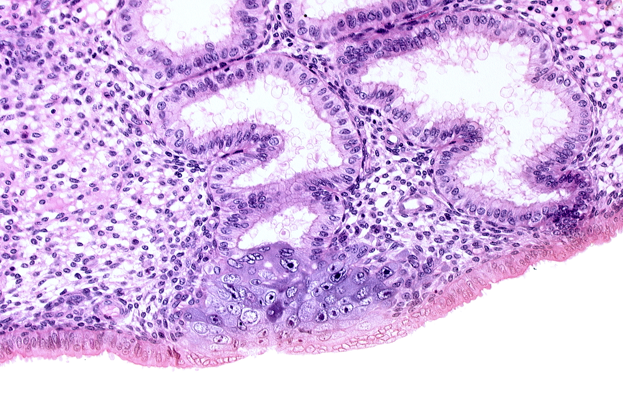 cytotrophoblast, edge of membranous trophoblast at abembryonic pole, endometrial epithelium, lumen of endometrial gland, solid syncytiotrophoblast, syncytiotrophoblast engulfing wall of endometrial gland, uterine cavity