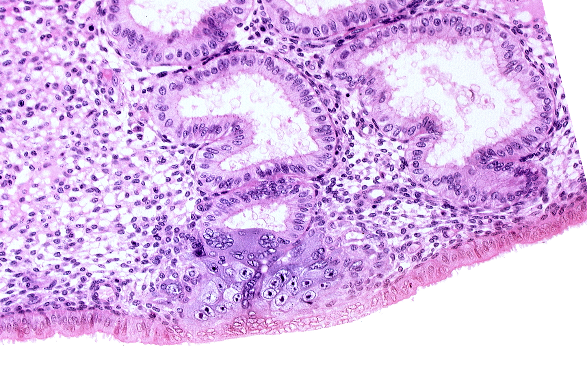 cytotrophoblast, edematous endometrial stroma (decidua), endometrial epithelium, endometrial gland, intact endometrial epithelium, solid syncytiotrophoblast