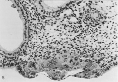 Amniotic cavity and bilaminar embryonic disc